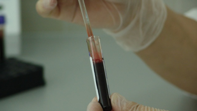 Krebs - Zwischen Bangen und Hoffen